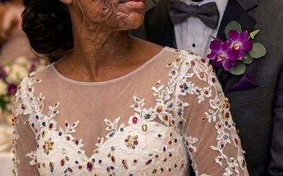 I MARRIED A BLIND MAN SO HE’D NEVER SEE MY SCARS