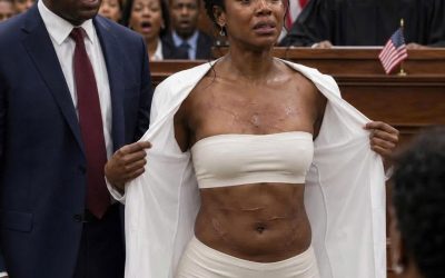 My husband thought I was just a weak housewife, someone he could bruise, silence, and lie about forever. But in court, I stood before the judge, opened my coat, and showed the scars he had explained away. “Objection?” I asked calmly. “Then let me testify.” As a former forensic doctor, I named the impact angle, healing yas timeline, and weapon type—until every sentence of his story collapsed.