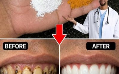 🌿🦷 Turmeric and Baking Soda: A Natural Remedy for Whitening and Protecting Your Teeth