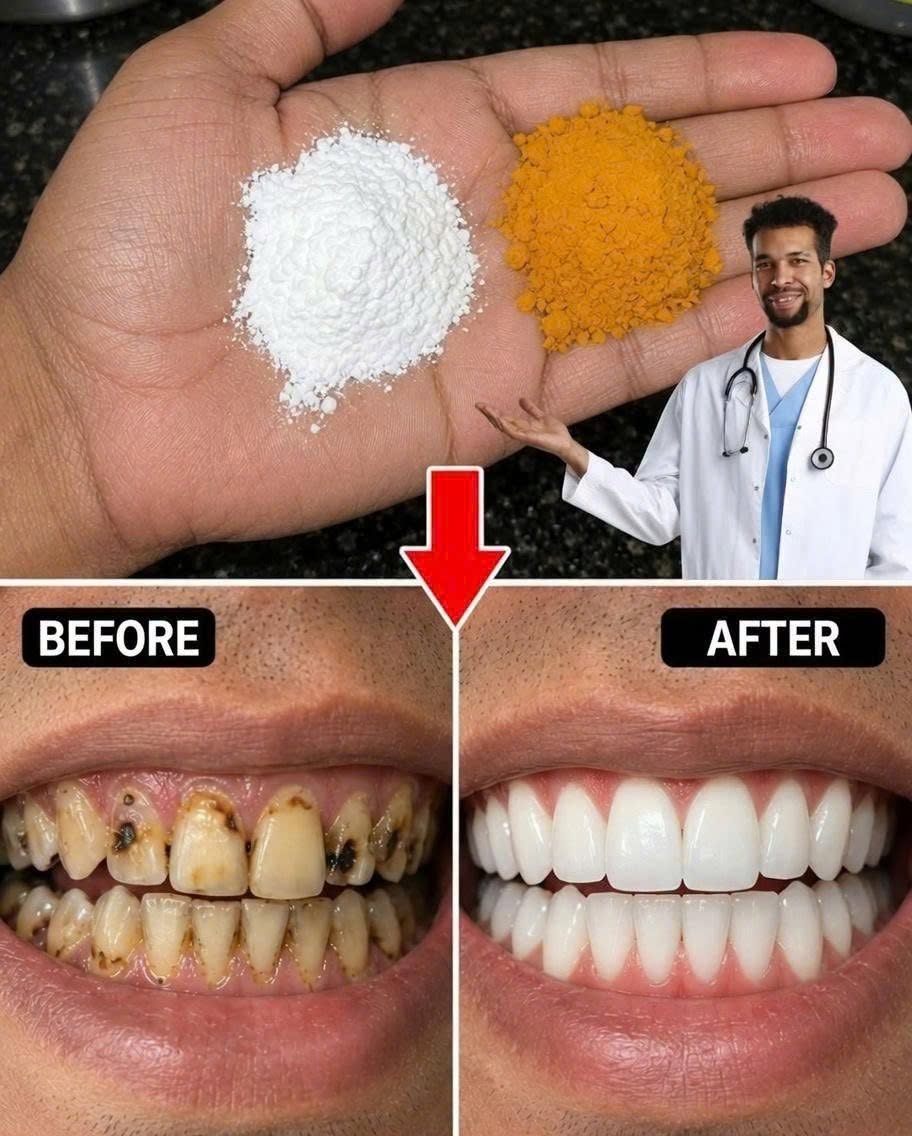 🌿🦷 Turmeric and Baking Soda: A Natural Remedy for Whitening and Protecting Your Teeth