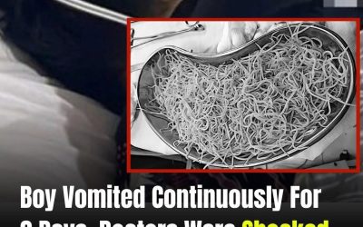 Doctors Were Shocked By What They Found Inside His Intestines…