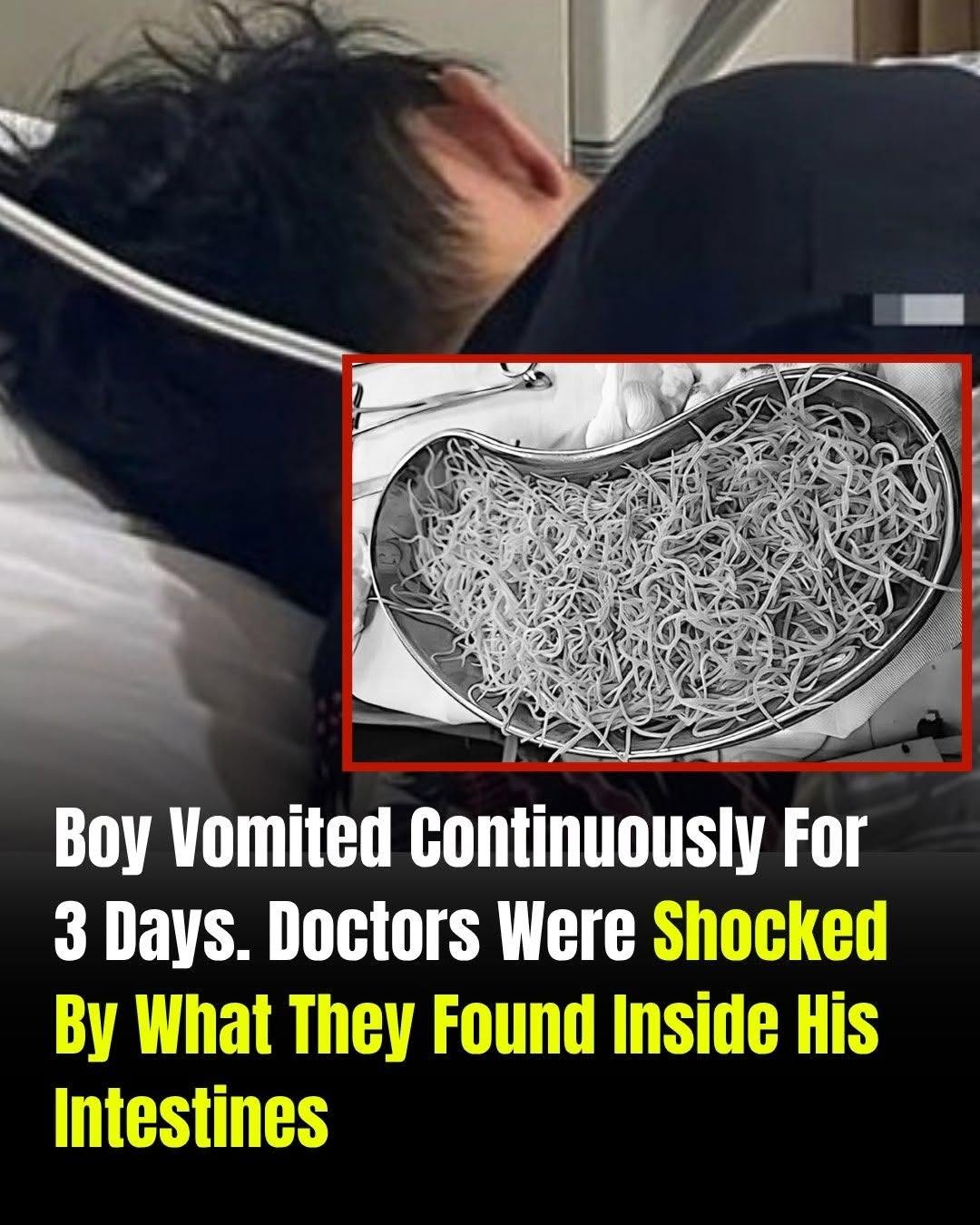 Doctors Were Shocked By What They Found Inside His Intestines…