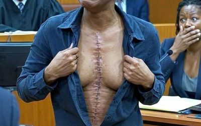 My family dragged me to court, accusing me of being a fake veteran. “She never served in the military. She made it all up to steal her grandfather’s money,” my mother growled under oath. I didn’t react. I just stared at the judge. But when I lifted my shirt to reveal the wound on my shoulder, everyone was completely astonished. punishment they never expected… My own mother and brother dragged me to court like someone tossing trash to the curb. To them, I was nothing but an obstacle blocking their path to an inheritance. My mother, Evelyn Vance, and my older brother, Derek, officially petitioned the court, labeling me a “fraudulent veteran.” They claimed I lied about my military service to steal sympathy and disgrace the Vance family name. I am Nora Vance, thirty-four years old, and I spent eight grueling years as a combat medic in the U.S. Army. I hold a Purple Heart and harbor the kind of bloody nightmares you don’t casually discuss at family barbecues. But my family never cared about the truth. They only wanted a narrative that justified destroying me. After my father died, I intentionally cut off all contact. My mother immediately began telling the entire town that I had simply “run away.” When I did show up for holidays, Derek would tap the empty spot on my jacket where a unit patch belonged and sneer, “What imaginary branch are you pretending to be in today?” I never argued back. The Army taught me not to waste precious energy making a fuss when people are bleeding. I kept my medals hidden in a shoebox and quietly worked grueling night shifts in a trauma ER. The real war began when Grandpa Arthur’s will was read. He left me his farm and a modest investment account—assets I had fought hard to keep out of my mother’s greedy reach. Barely two weeks later, the lawsuit hit my doorstep: fraud, defamation, and “theft of value.” They wanted the court to officially brand me a liar so they could legally seize the entire estate. On the morning of the hearing, my mother strutted into the courtroom as if she owned it. Derek followed close behind, smirking in a cheap, surplus camouflage jacket specifically chosen to mock me. He had absolutely no idea that I held the military records proving he was dishonorably discharged from boot camp for theft after just eight weeks. When the clerk called our case, my mother confidently took the witness stand. She locked eyes with me, her voice sharp with practiced, theatrical indignation. “She never served in the military!” Evelyn snarled under oath. “We have financial records proving she was cashing checks right here in Ohio the entire time, stealing our family’s money!” I didn’t flinch. I didn’t shed a single tear, nor did I bother to plead my case. I simply sat with my back straight, my gaze locked onto the Honorable Judge Marian Sterling, and waited. Judge Sterling’s face remained utterly unreadable as her pen moved in slow, deliberate strokes. When my mother finally finished her performance, the judge leaned forward. “Miss Vance,” the judge addressed me sternly, “this is an incredibly serious charge. Do you have proof of your military service?” “Yes, Your Honor, I do,” I replied clearly and firmly. “And I have something else to show the court.” A collective gasp and nervous whispers rippled through the courtroom. My mother’s mouth curved into a smug smirk, entirely convinced she had already won. I calmly stood up, took off my navy blazer, and reached for the collar of my blouse. My fingers rested right where the fabric met my left shoulder. “Permission to show the court,” I requested with a terrifying, absolute calm. Judge Sterling gave a single nod. “Proceed.” I pulled down the fabric just enough to expose the massive, jagged, pale scar carved deep into my flesh. The entire courtroom plunged into a dead silence… (I know you’re all very curious about the next part, please leave a “YES” comment below! Part 2 will be updated below in the first c0mment )