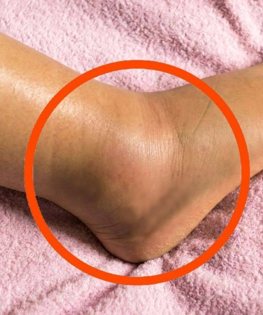 If You Notice Your Legs Are Swollen, Doctors Warn It Could Be a Sign of part1